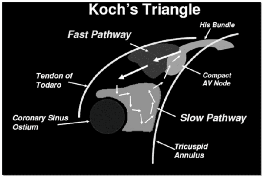 Koch triangle contains AV node and His bundle