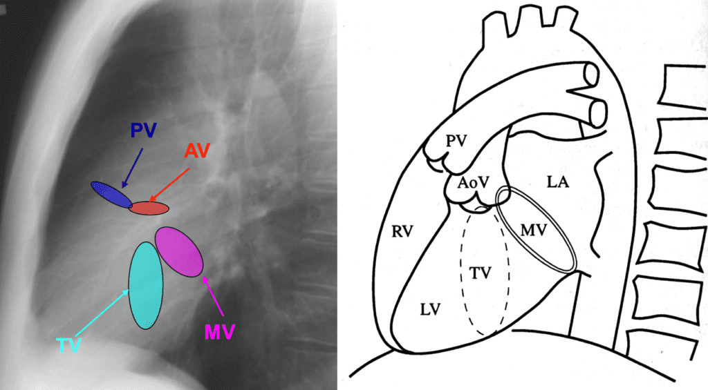 Valve anatomy on chest Lat