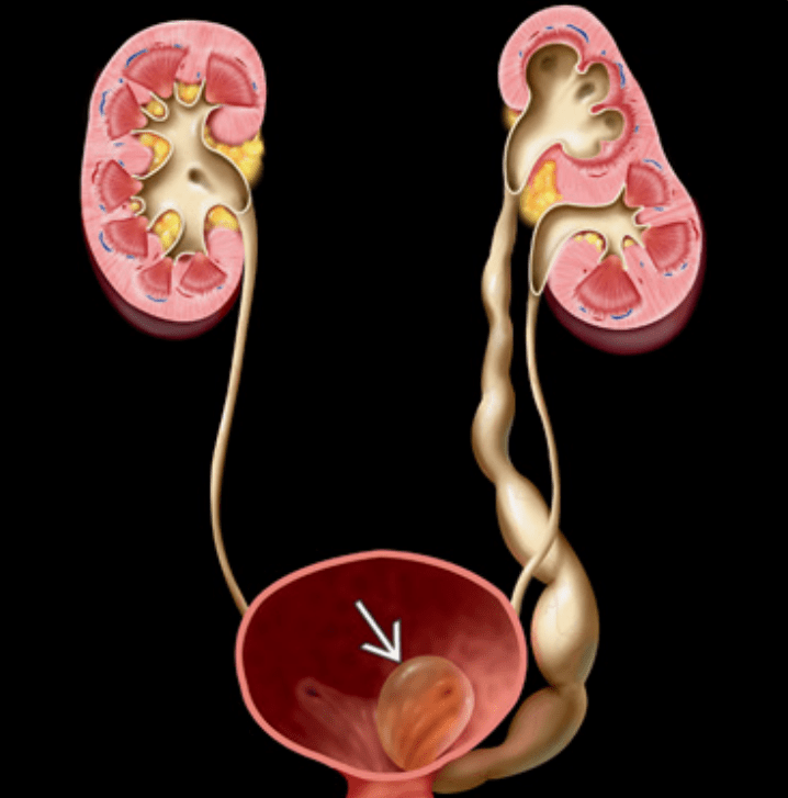 Illrustration from Diagnostic imaging, Genitourinary