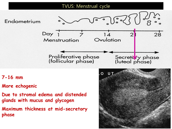 Summary of TVUS: Menstrual cycle